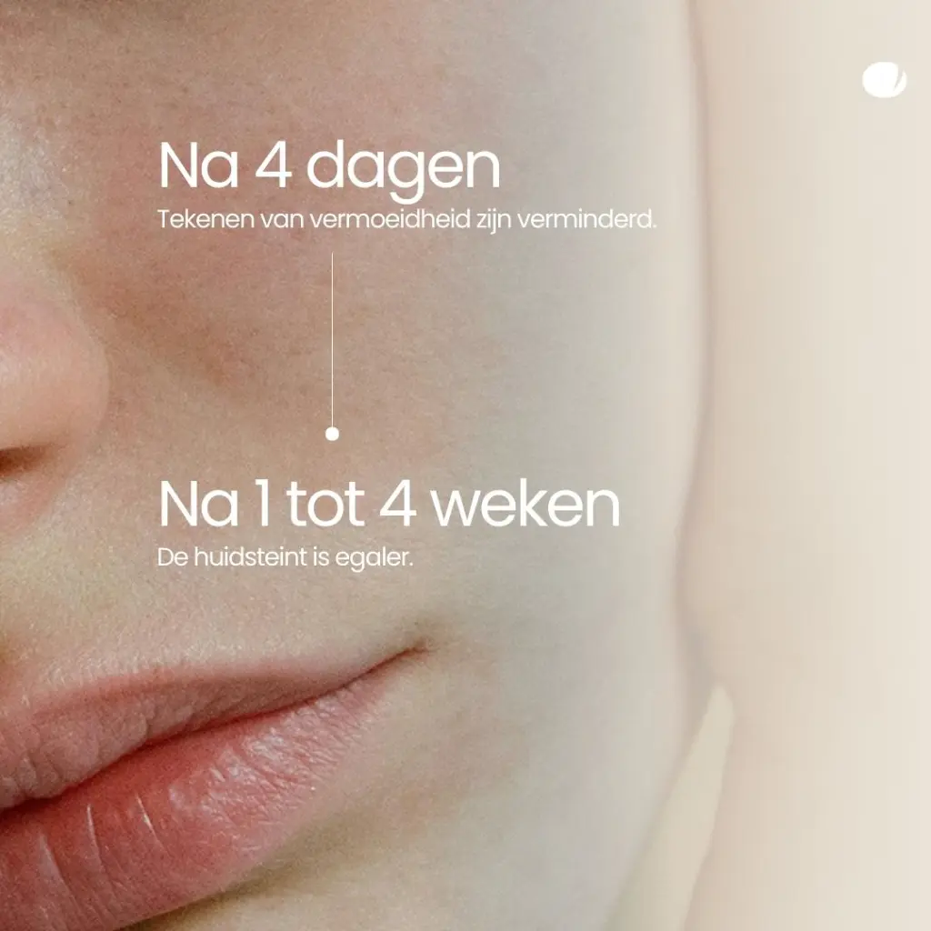 tinge-skin-booster-night-resultaten.webp